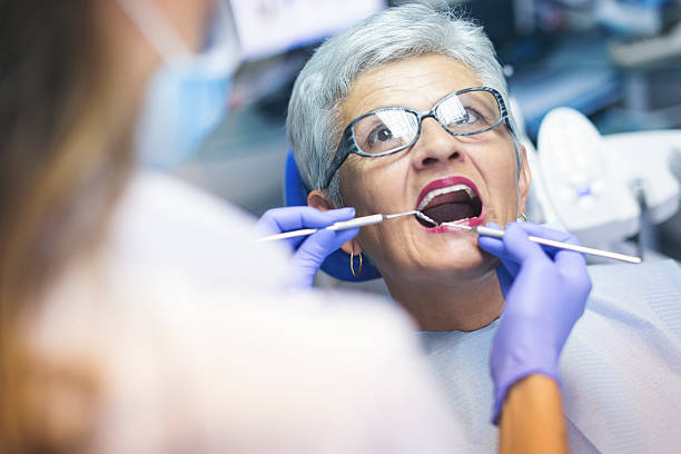 Dental Bonding in Holley, NY